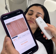 Professional Skin Consultation